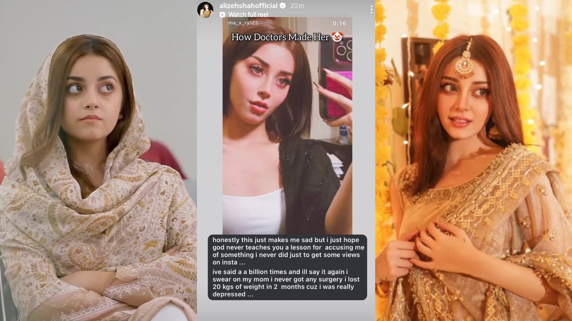 “I was really depressed”: Alizeh Shah shuts down cosmetic surgery rumours; credits transformation to mental health struggles.